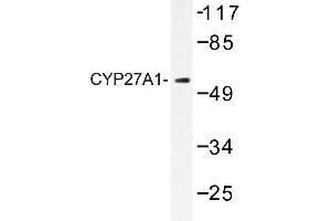 Image no. 1 for anti-Cytochrome P450, Family 27, Subfamily A, Polypeptide 1 (CYP27A1) antibody (ABIN272272) (CYP27A1 anticorps)