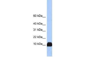 Profilin 1 antibody used at 1 ug/ml to detect target protein. (PFN1 anticorps  (N-Term))