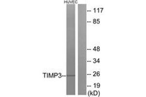 Western Blotting (WB) image for anti-TIMP Metallopeptidase Inhibitor 3 (TIMP3) (AA 91-140) antibody (ABIN2889268) (TIMP3 anticorps  (AA 91-140))