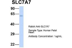 Host:  Rabbit  Target Name:  SLC7A7  Sample Type:  Human Fetal Heart  Antibody Dilution:  1. (SLC7A7 anticorps  (Middle Region))
