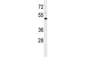 IL1R2 antibody western blot analysis in WiDr lysate.