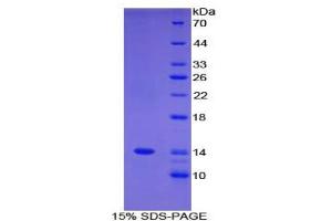 SDS-PAGE analysis of Human FAM19A3 Protein. (FAM19A3 Protéine)