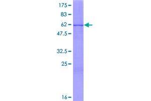 Image no. 1 for Myeloid Leukemia Factor 1 (MLF1) (AA 1-268) protein (GST tag) (ABIN1310998)