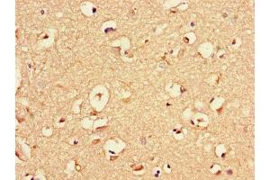 Immunohistochemistry of paraffin-embedded human brain tissue using ABIN7145523 at dilution of 1:100 (Nerve Growth Factor anticorps  (AA 122-218))