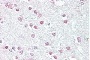 anti-Melanocortin 5 Receptor (MC5R) (N-Term) antibody