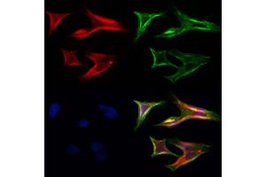 ABIN6264742 and ABIN6272414 staining Hela cells by IF/ICC. (RHOG anticorps  (Internal Region))