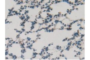 IHC-P analysis of Rat Lung Tissue, with DAB staining. (SFTPB anticorps  (AA 111-329))
