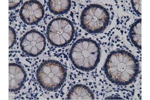 Immunohistochemical staining of paraffin-embedded Human Kidney tissue using anti-CRYM mouse monoclonal antibody. (CRYM anticorps)