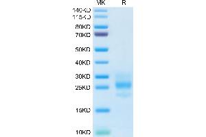 Human M-CSF on Tris-Bis PAGE under reduced condition. (M-CSF/CSF1 Protein (AA 33-190))