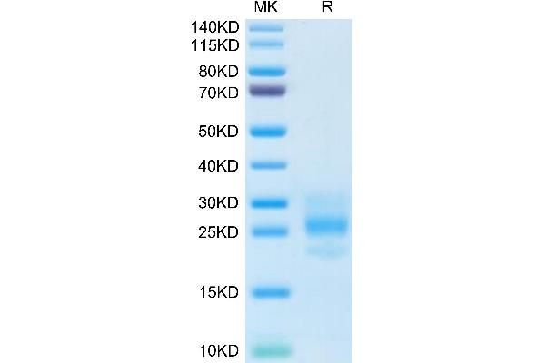 M-CSF/CSF1 Protein (AA 33-190)