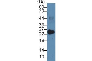 Detection of MYL3 in Porcine Heart lysate using Polyclonal Antibody to Myosin Light Chain 3, Alkali, Ventricular, Slow Skeletal (MYL3) (MYL3/CMLC1 anticorps  (AA 5-181))