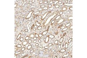 IHC analysis of SGCE using anti-SGCE antibody (ABIN7601544). (SGCE anticorps  (AA 38-407))