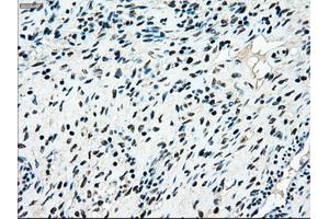 Immunohistochemical staining of paraffin-embedded colon tissue using anti-MAP2K4mouse monoclonal antibody. (MAP2K4 anticorps)