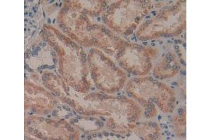 Used in DAB staining on fromalin fixed paraffin- embedded Kidney tissue