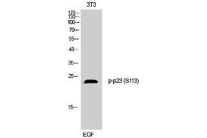Western Blotting (WB) image for anti-Cyclin-Dependent Kinase 5, Regulatory Subunit 1 (p35) (CDK5R1) (pSer113) antibody (ABIN3179659) (CDK5R1 anticorps  (pSer113))