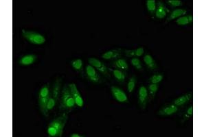 Immunofluorescent analysis of Hela cells using ABIN7153414 at dilution of 1:100 and Alexa Fluor 488-congugated AffiniPure Goat Anti-Rabbit IgG(H+L)