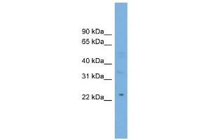 MBL2 antibody used at 1 ug/ml to detect target protein. (MBL2 anticorps  (Middle Region))