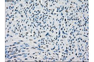 Immunohistochemical staining of paraffin-embedded endometrium tissue using anti-PORmouse monoclonal antibody. (POR anticorps)