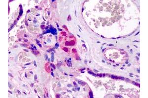 Human Placenta: Formalin-Fixed, Paraffin-Embedded (FFPE) (GATA3 anticorps  (N-Term))