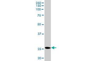 PRL MaxPab rabbit polyclonal antibody.