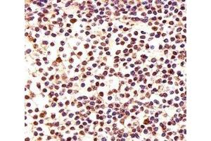 Immunohistochemical analysis of paraffin-embedded human lymph using PCNA antibody at 1:25 dilution.