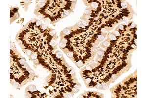 ABIN6260553 and ABIN6272990 at 1/100 staining Rat colon tissue by IHC-P. (AGTPBP1 anticorps  (Internal Region))