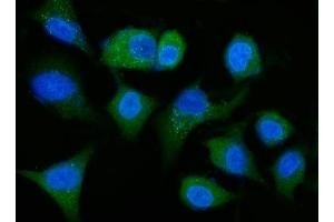 IF analysis of ALDH1A1 using anti-ALDH1A1 antibody (ABIN7602128). (ALDH1A1 anticorps  (AA 6-342))