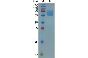 Mouse CD47 Protein, hFc Tag on SDS-PAGE under reducing condition.