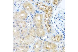 Immunohistochemistry of paraffin-embedded rat kidney using RPS2 antibody (ABIN5975423) at dilution of 1/100 (40x lens). (RPS2 anticorps)