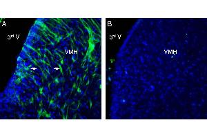 Expression of GPR139 in rat ventromedial hypothalamus (VMH). (GPR139 anticorps  (Intracellular))
