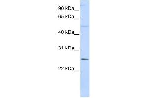 WB Suggested Anti-FTHL17 Antibody Titration:  0. (FTHL17 anticorps  (N-Term))