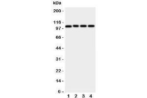 Western blot testing of ADAM19 antibody; Lane 1: rat spleen;  2: (r) intestine;  3: (r) brain;  4: human HeLa cell lysate.