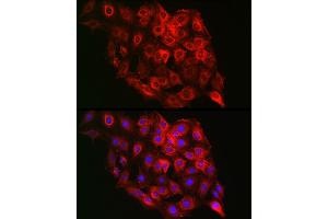 Immunofluorescence analysis of C6 cells using PSMD8 Rabbit pAb (ABIN6129443, ABIN6146347, ABIN6146348 and ABIN6222706) at dilution of 1:100 (40x lens). (PSMD8 anticorps  (AA 101-350))