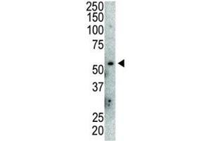 Western blot analysis of anti-MDM2 antibody and mouse lung tissue lysate