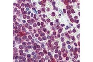 IHC analysis of FFPE human spleen tissue stained with Cdc25A antibody