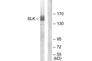 Western blot analysis of extracts from COLO205 cells, using SLK antibody. (SLK anticorps  (C-Term))