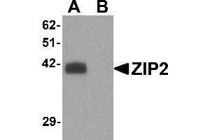 Western Blotting (WB) image for anti-Solute Carrier Family 39 (Zinc Transporter), Member 2 (Slc39a2) (N-Term) antibody (ABIN1031682)
