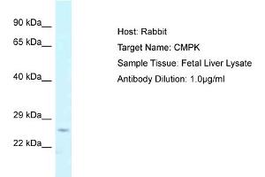 Host: Rabbit Target Name: CMPK Sample Tissue: Human Fetal Liver Antibody Dilution: 1ug/ml (Cytidine Monophosphate (UMP-CMP) Kinase 1, Cytosolic (CMPK1) (N-Term) anticorps)