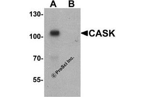 Western Blotting (WB) image for anti-Calcium/calmodulin-Dependent serine Protein Kinase (MAGUK Family) (CASK) (N-Term) antibody (ABIN1031293) (CASK anticorps  (N-Term))