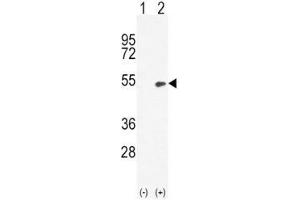 Western blot analysis of BMP4 antibody and 293 cell lysate (2 ug/lane) either nontransfected (Lane 1) or transiently transfected (2) with the BMP4 gene. (BMP4 anticorps  (AA 5-34))