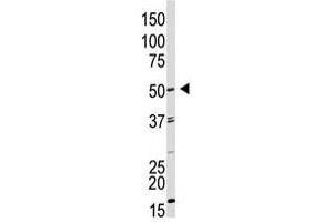 Image no. 1 for anti-Growth Differentiation Factor 9 (GDF9) (AA 37-67), (N-Term) antibody (ABIN357463) (GDF9 anticorps  (N-Term))