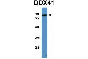 Host:  Rabbit  Target Name:  DDX41  Sample Type:  Human Fetal Lung  Antibody Dilution:  1. (DDX41 anticorps  (N-Term))
