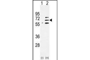 Western blot analysis of Parp6 (arrow) using rabbit polyclonal Parp6 Antibody (C-term) (ABIN390248 and ABIN2840713). (PARP6 anticorps  (C-Term))
