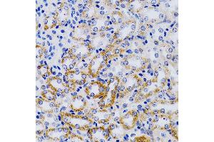Immunohistochemistry of paraffin-embedded mouse kidney using CYP24 antibody (805) at dilution of 1:200 (40x lens).