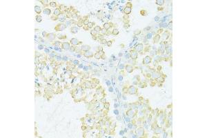 Immunohistochemistry of paraffin-embedded mouse testis using MYH10 antibody.
