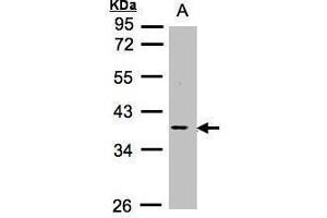 WB Image Sample (30μg whole cell lysate) A:Raji , 10% SDS PAGE antibody diluted at 1:1000 (MCL-1 anticorps  (Center))