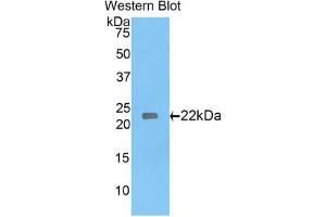 Western blot analysis of the recombinant protein. (Laminin gamma 1 anticorps  (AA 1228-1404))
