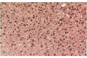 Immunohistochemistry of paraffin-embedded Rat brain tissue using Tau Polyclonal Antibody at dilution of 1:200. (tau anticorps)