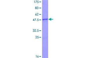 Image no. 1 for Ras Homolog Gene Family, Member B (RHOB) (AA 1-196) protein (GST tag) (ABIN1318008)