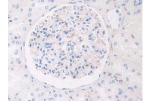 Used in DAB staining on fromalin fixed paraffin- embedded kidney tissue